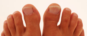 gljivice na noktima nogu