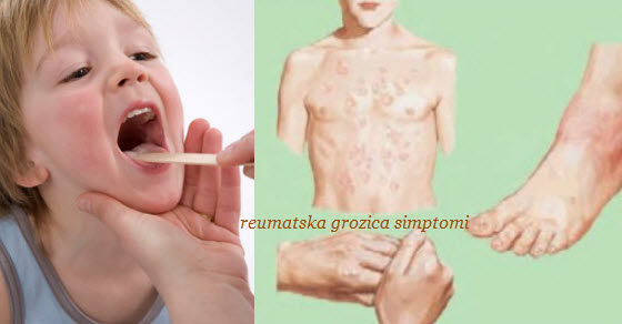 reumatska groznica simptomi