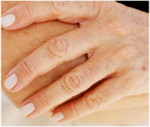staračke pege po rukama javljaju se već oko 40 godine