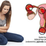 upala jajnika simptomi | lecenje | ovaritis
