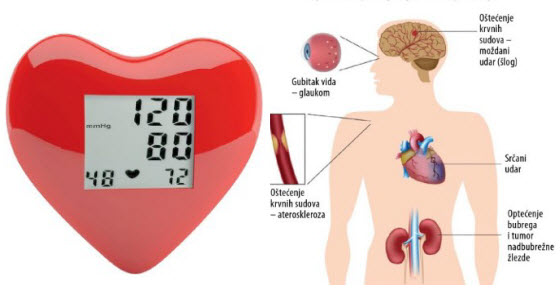kako prirodno smanjiti krvni pritisak