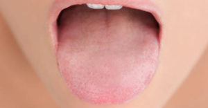 eliminišite judarnji zadah iz usta