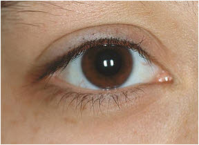 očni pritisak simptomi kod mladih ljudi